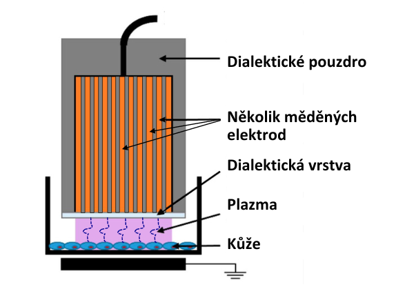 Technologie plazmové sprchy